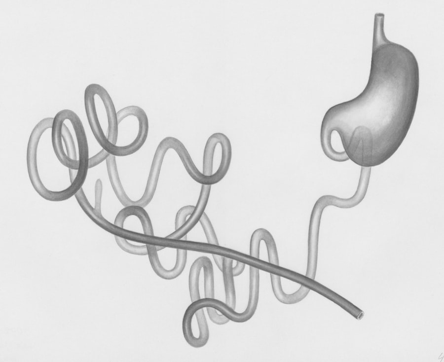 antikythera mechanism