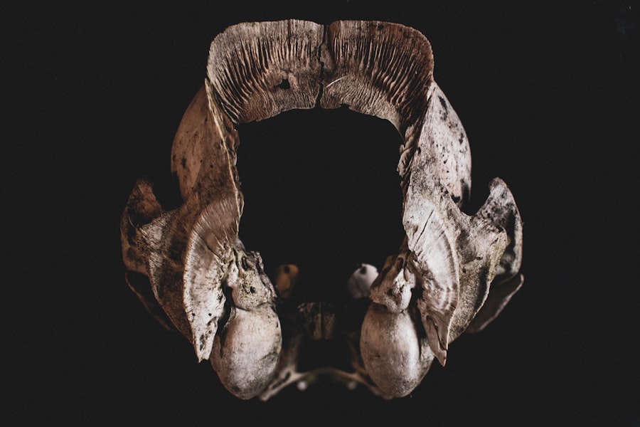 Photo muon radiography