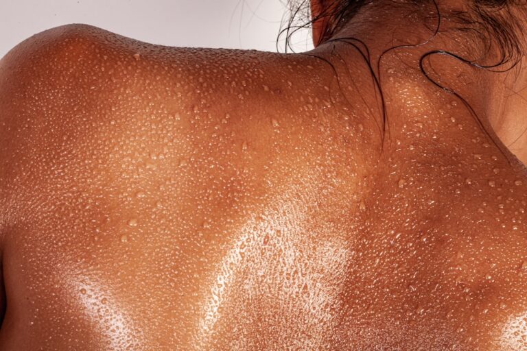 Polyester Clothes Rash Dealing with Skin Rashes from New Clothes