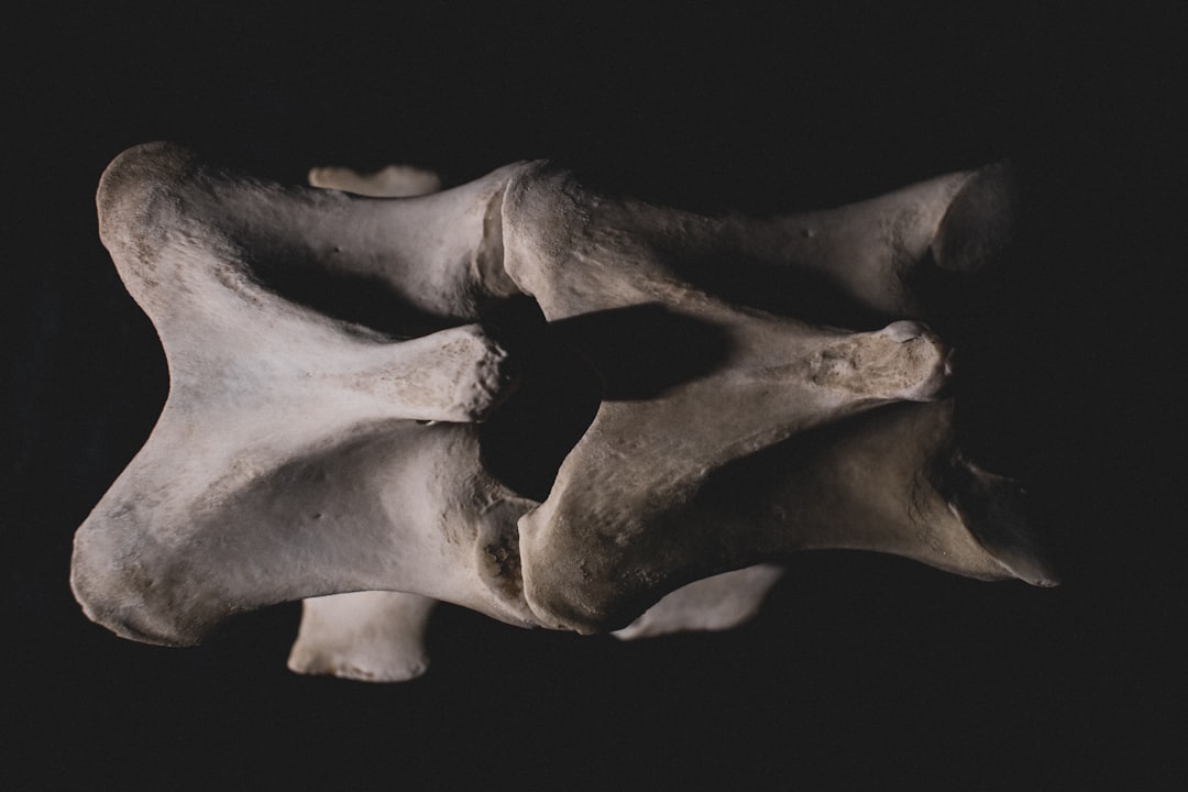 Photo bone density
